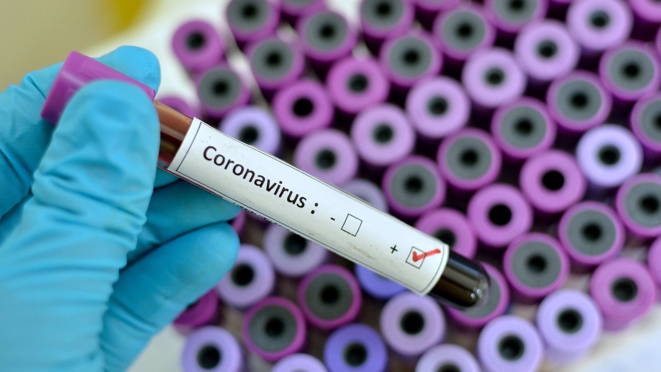 coronavirus vial